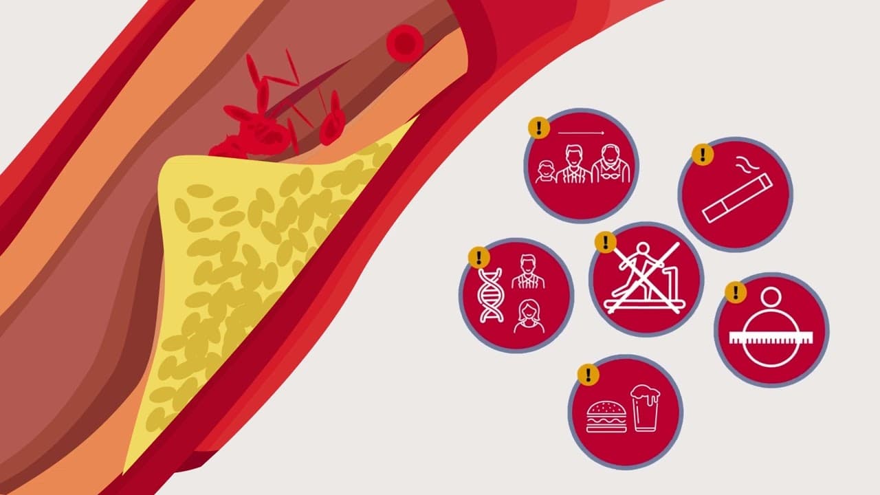 How Much Cholesterol Per Day