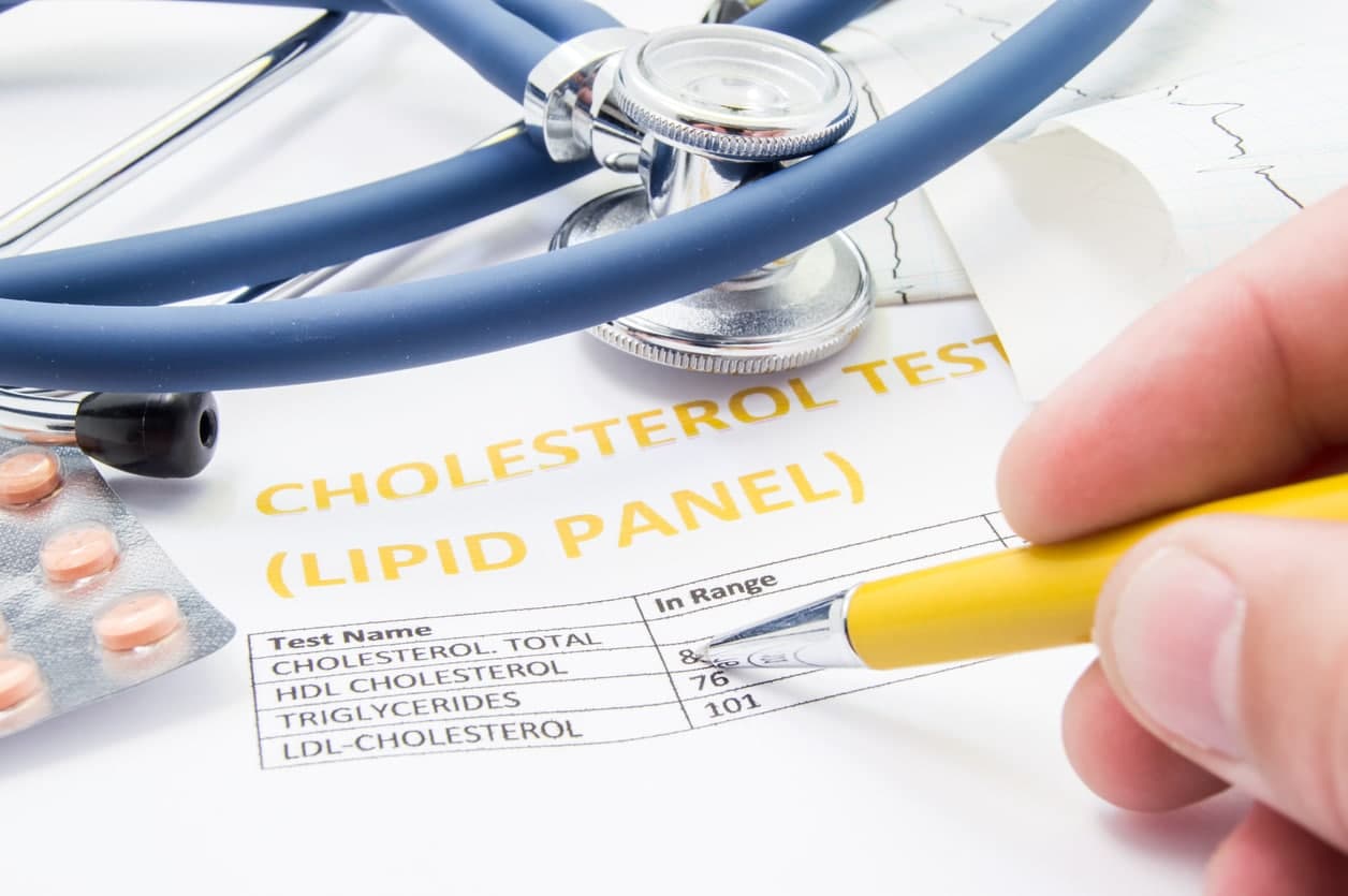 How Much Cholesterol Per Day